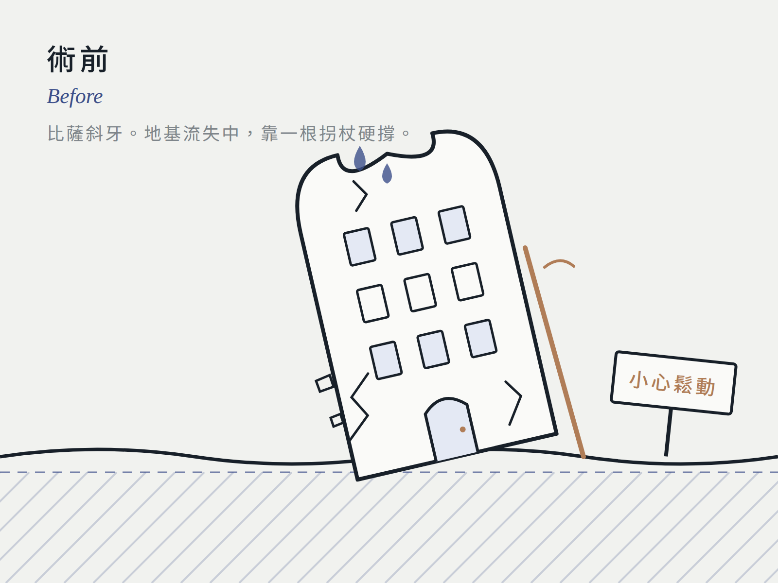 距離神經只有幾毫米：先在電腦上植好，再進手術室（術前）